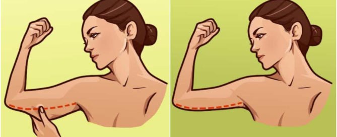 get rid of Flabby Arms for Good